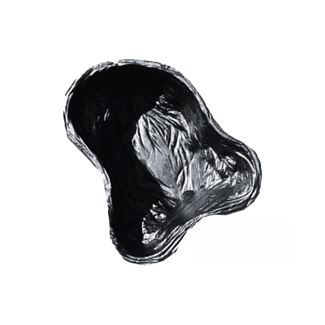 Sicce Happy Pond Kit 2